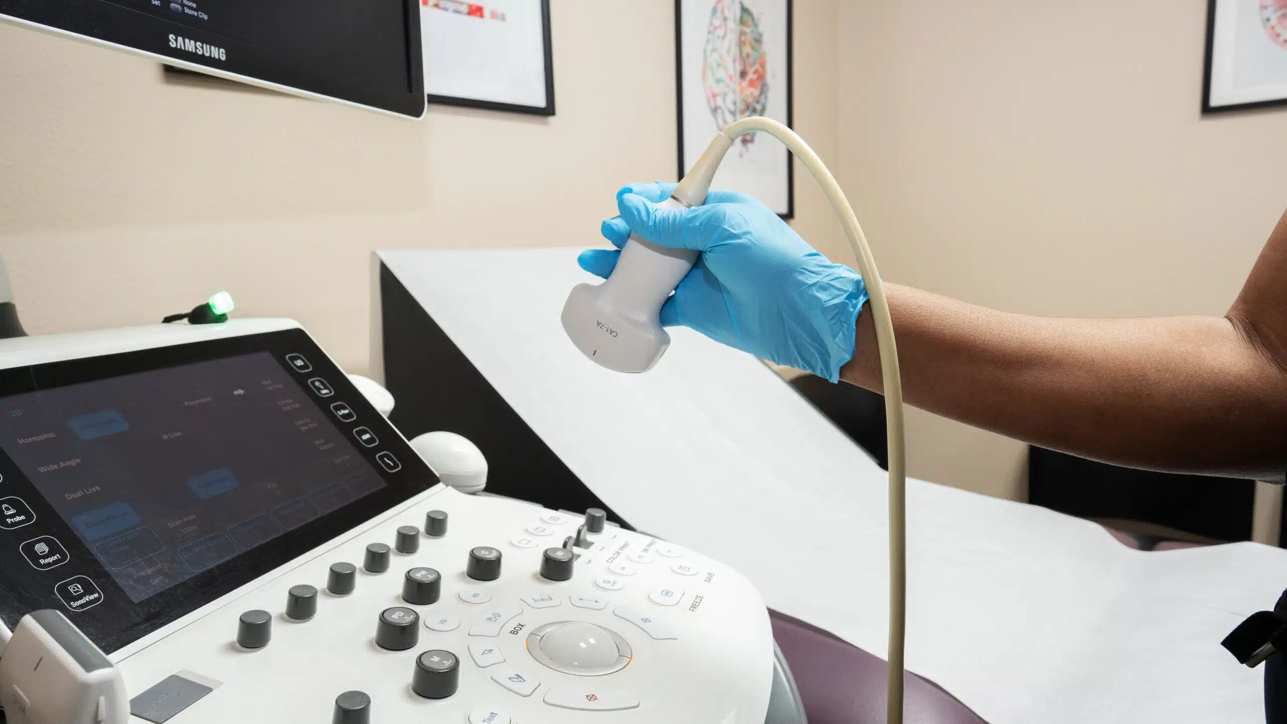 ultrasound imaging concepts close up on sonogram machine being prepared