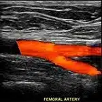 2d ultrasound