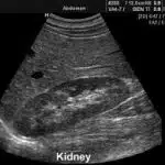 2d ultrasound