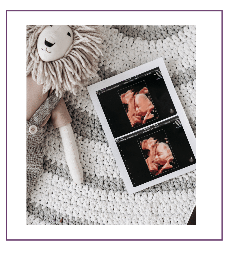 3D ultrasound photo printout next to a stuffed lion doll on a knitted rug